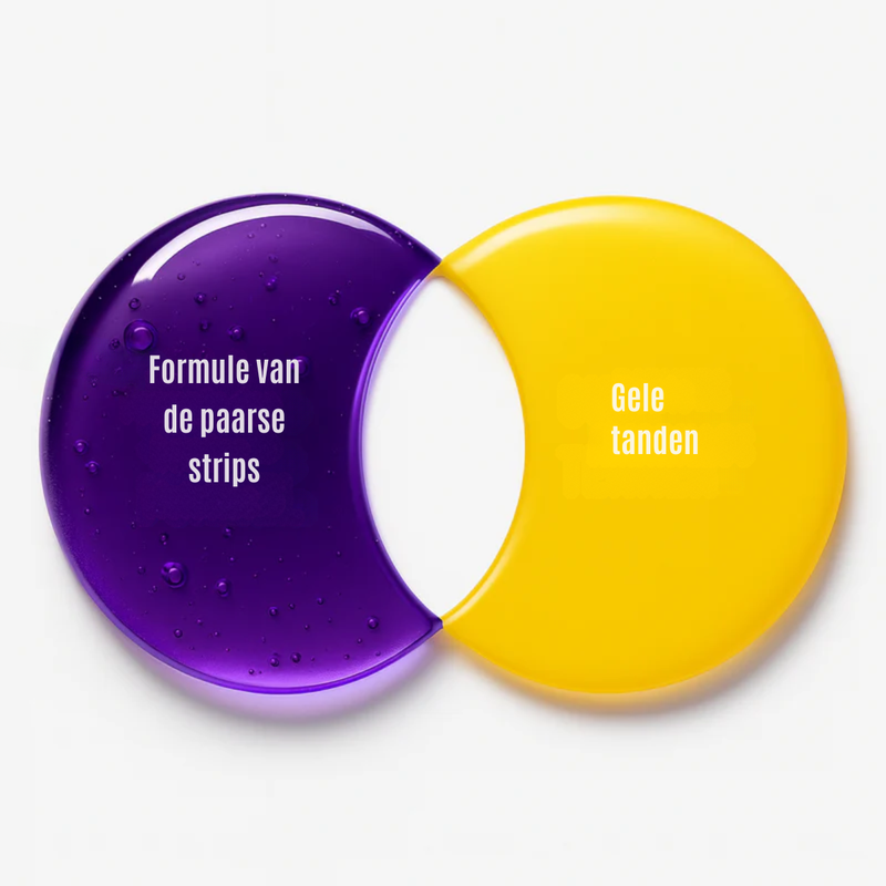 Direct wittere tanden