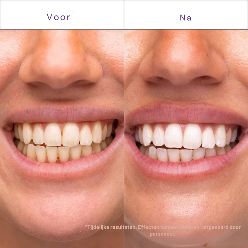 Professionele resultaten